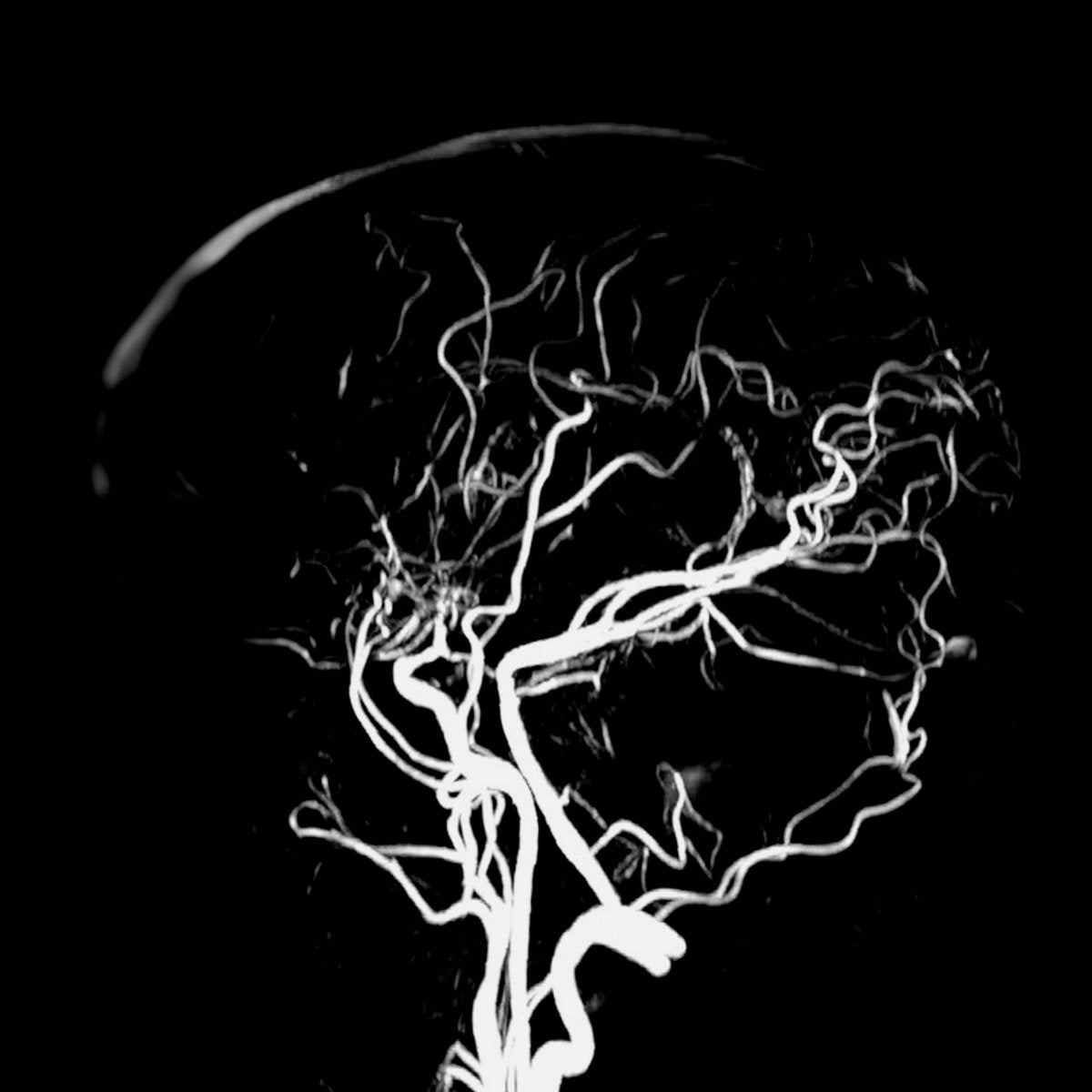 Nick Pino- The Sounds Of Malady