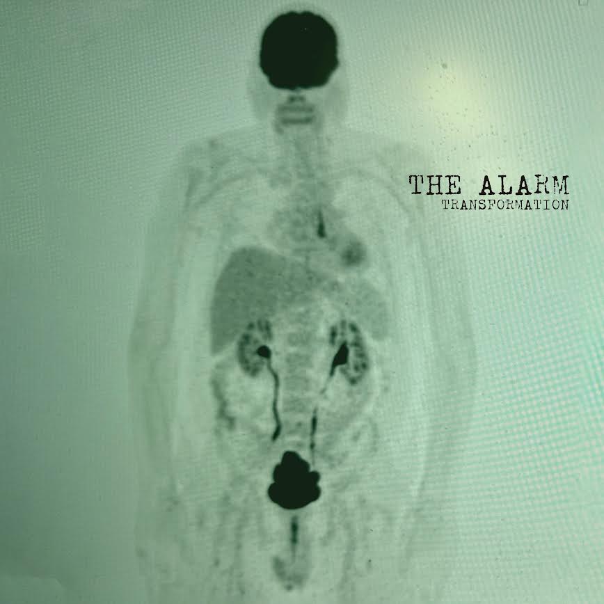 The Alarm- Transformation PREORDER OUT 5/29