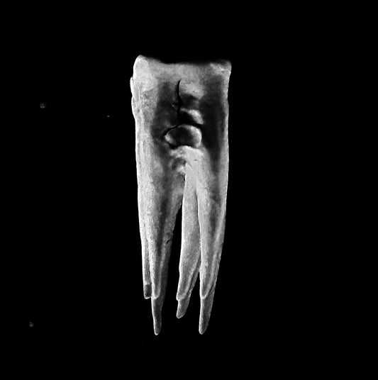 Chalk Teeth- Chalk Teeth