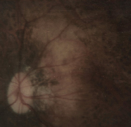 Pale Spektre- Bereft Of Xerotic Layers